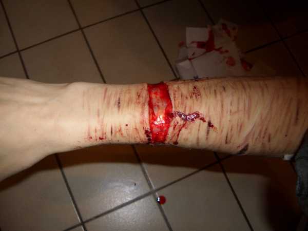File:Emo Girl Cuts Herself Picture-18.jpg