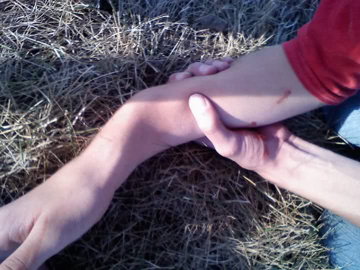 File:Skateboard Injury 4.jpg